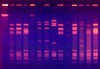 Ethidium Bromide